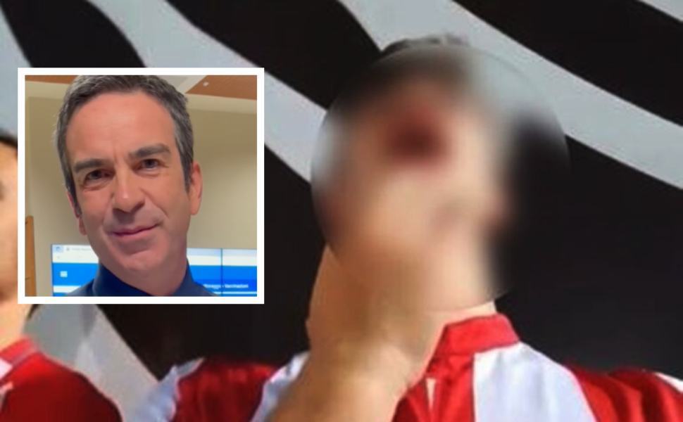 Tifoso Vicenza contro calabresi? Occhiuto: "un cretino, va punito" 51 tifoso vicenza roberto occhiuto