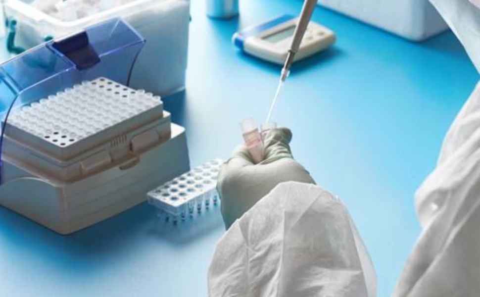 variante delta laboratorio 1