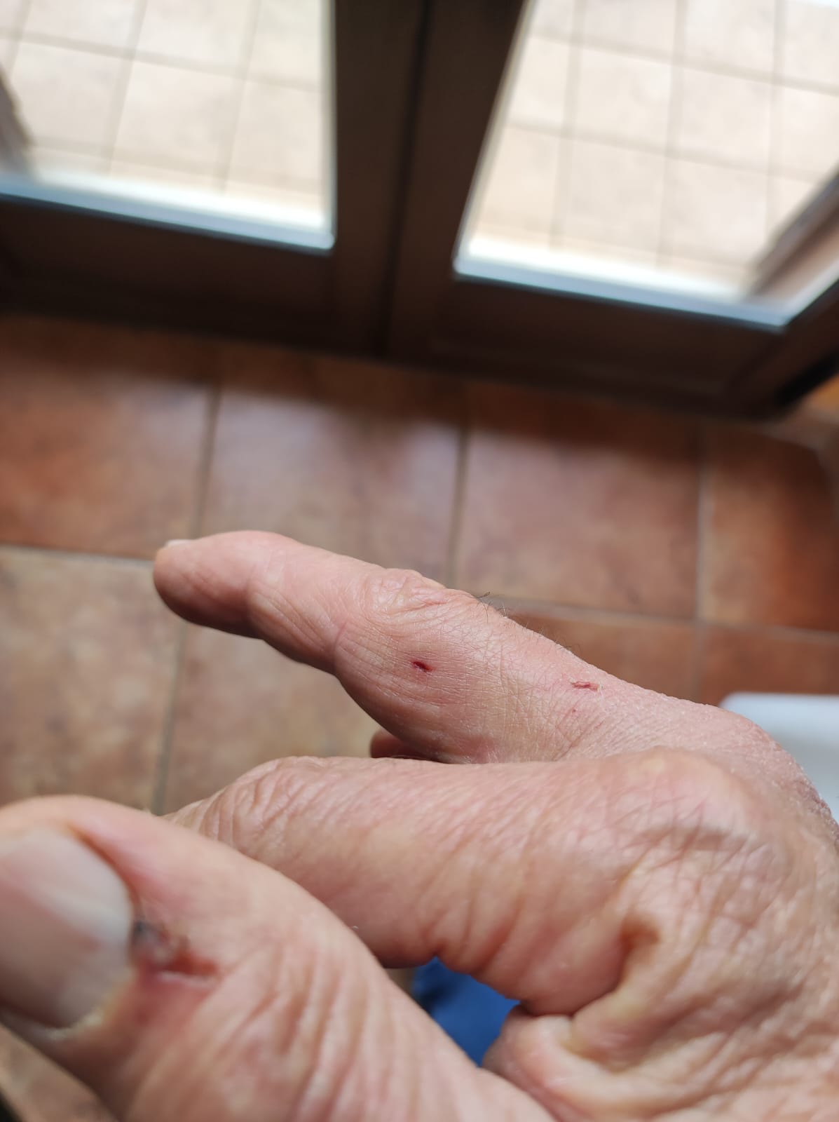 San Pietro in Guarano: aggredito insieme al suo cane, il rimpallo per sporgere denuncia 52 foto aggressione san pietro in guarano 1