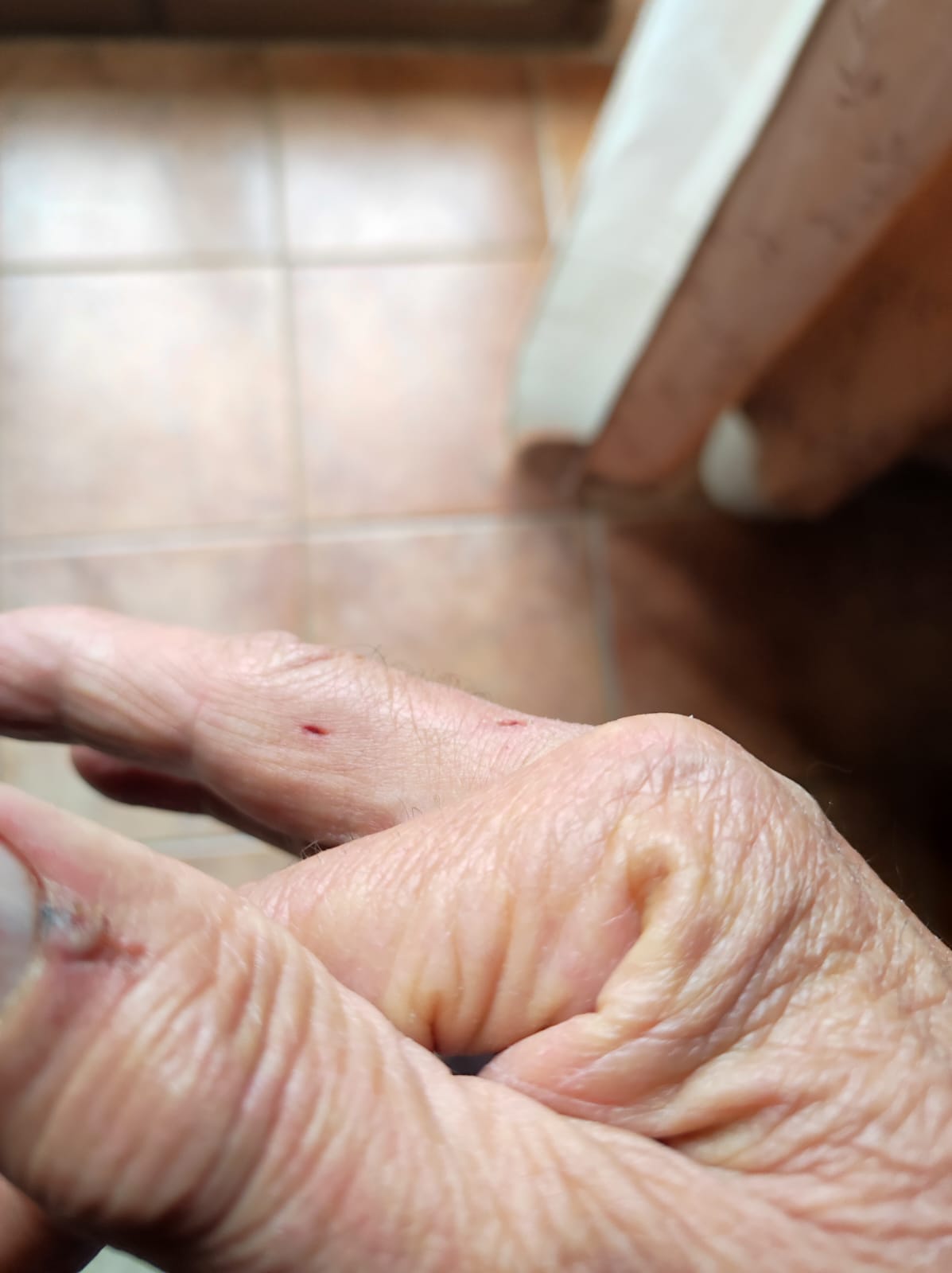 San Pietro in Guarano: aggredito insieme al suo cane, il rimpallo per sporgere denuncia 53 foto aggressione san pietro in guarano 3