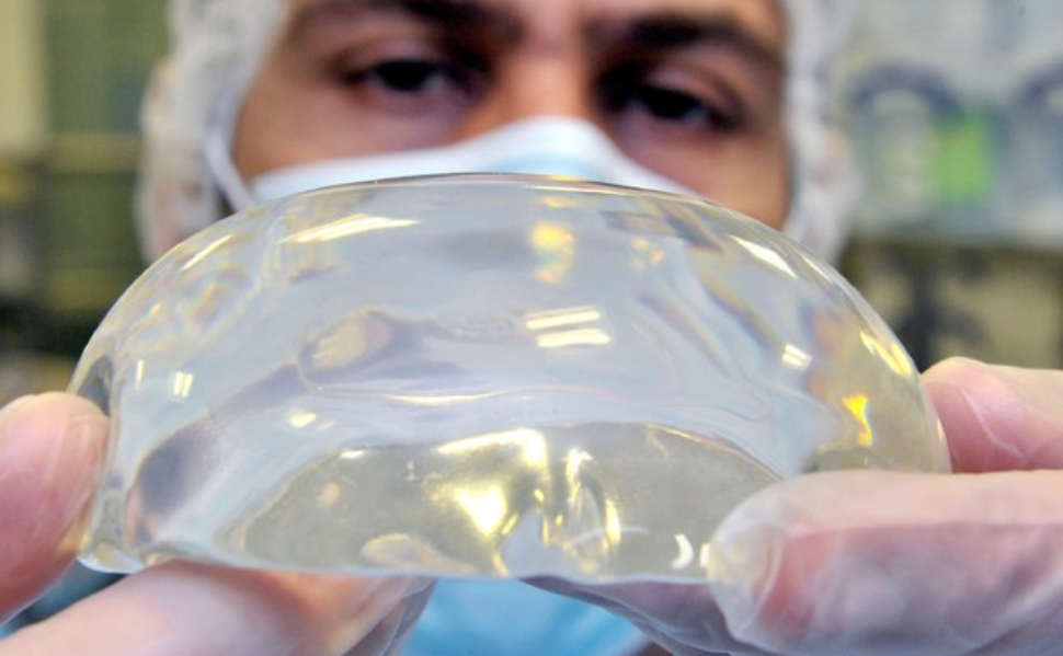 protesi-seno-calabria