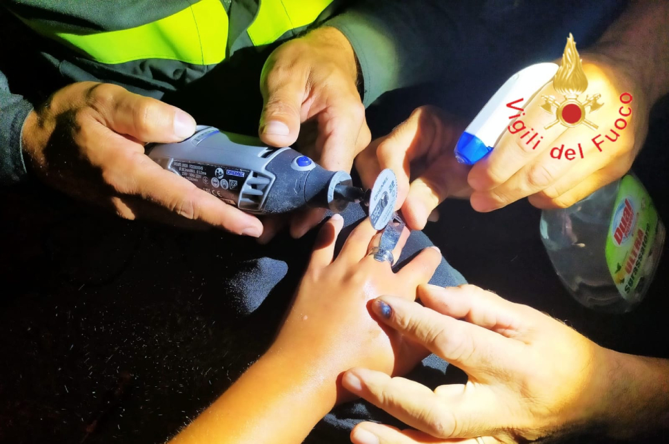 Anello incastrato al dito, 14enne si presenta in ospedale: intervengono i vigili del fuoco 51 anello-incastrato