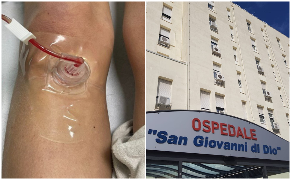 accesso-intraosseo-crotone