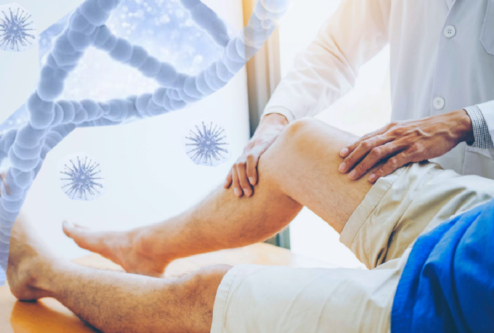 Sindrome Guillain-Barre