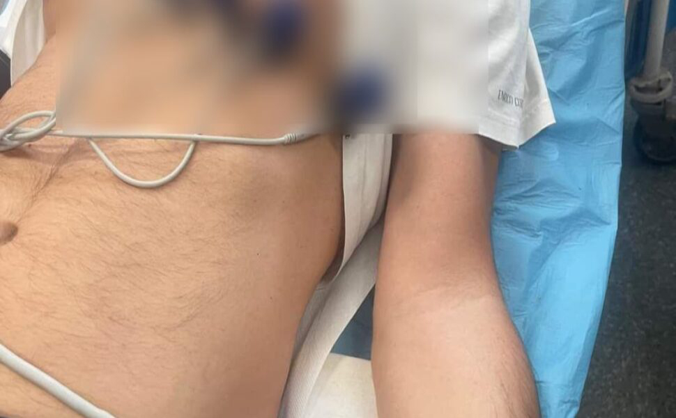 Aggressione Diamante