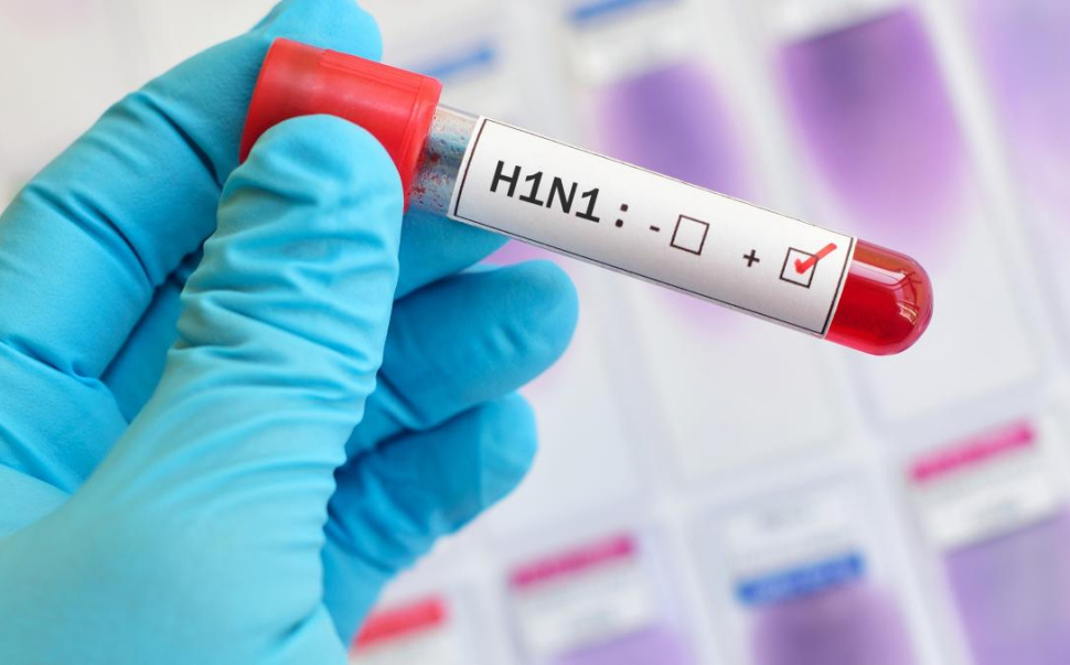 Influenza suina: salgono a 3 i calabresi ricoverati in gravi condizioni e sottoposti ad ECMO 58 H1N1