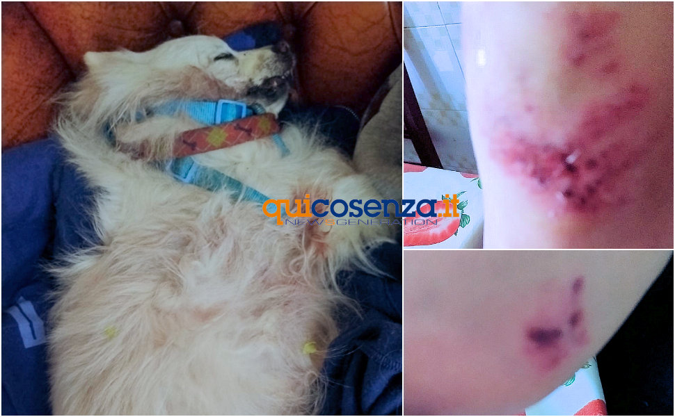 Volpino e padrona aggrediti pitbull Cosenza