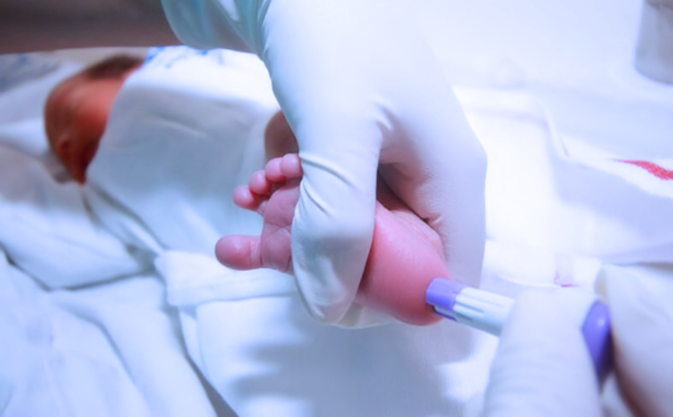 Anche in Calabria lo screening neonatale per la SMA. Diagnosi precoce ai nuovi nati in tutti i punti nascita 71 Screening Neonatale per la SMA Calabria