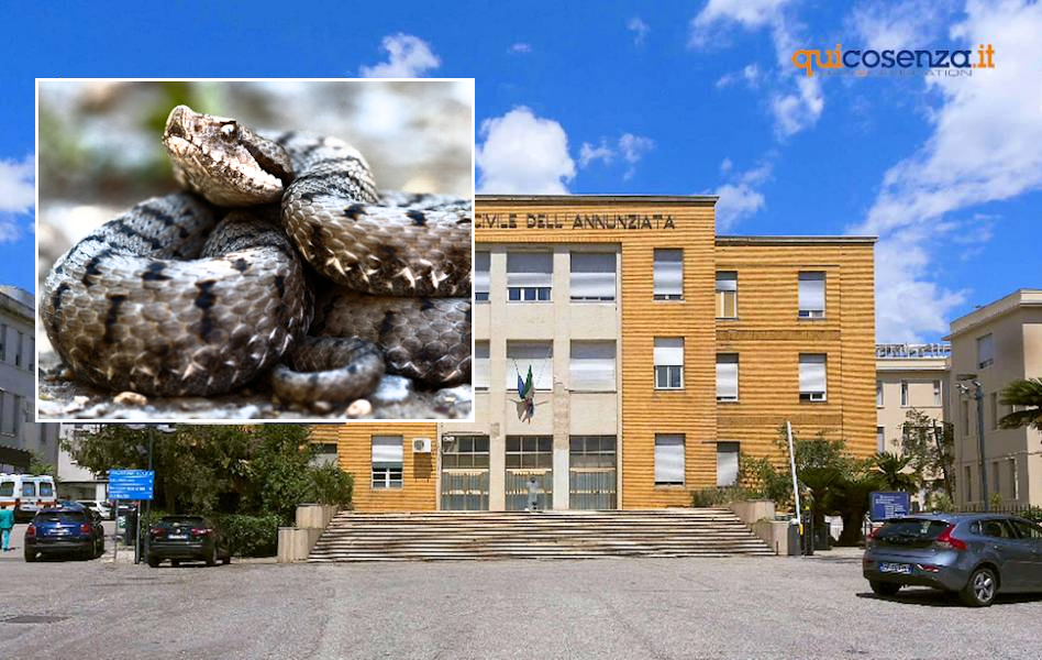 Rende, bimbo di 3 anni morso da una vipera. Ricoverato in terapia intensiva all'Annunziata 69 Annunziata Vipera