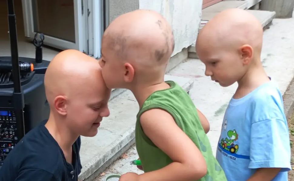 A Cosenza arriva la Giornata Nazionale dell'Alopecia Areata: la battaglia per il riconoscimento ufficiale 52 Giornata Nazionale dell'Alopecia Areata Cosenza