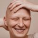 A Cosenza arriva la Giornata Nazionale dell'Alopecia Areata: la battaglia per il riconoscimento ufficiale 62 Giornata Nazionale dell'Alopecia Areata Cosenza