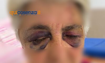 cosenza_aggressioni
