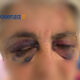 cosenza_aggressioni