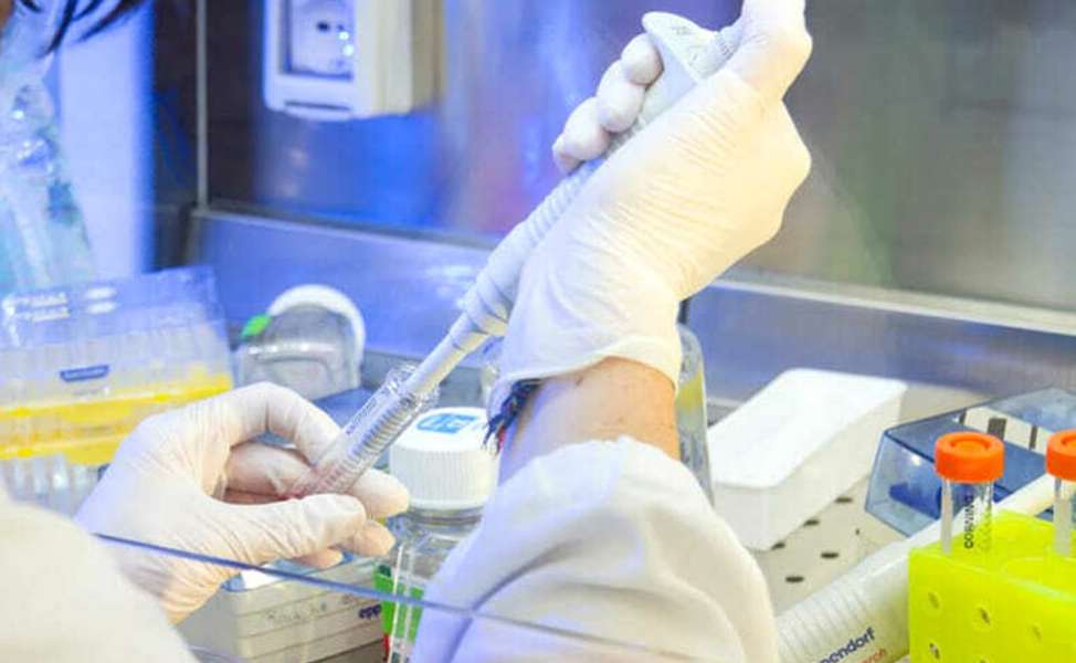 Influenza aviaria: primo caso umano in Italia, cosa sappiamo sul ceppo H9N2 52 influenza aviaria 02