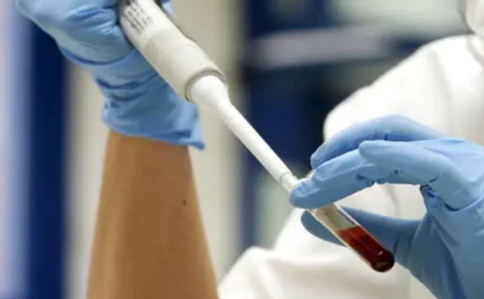 Influenza aviaria: primo caso umano in Italia, cosa sappiamo sul ceppo H9N2 53 influenza aviaria 03