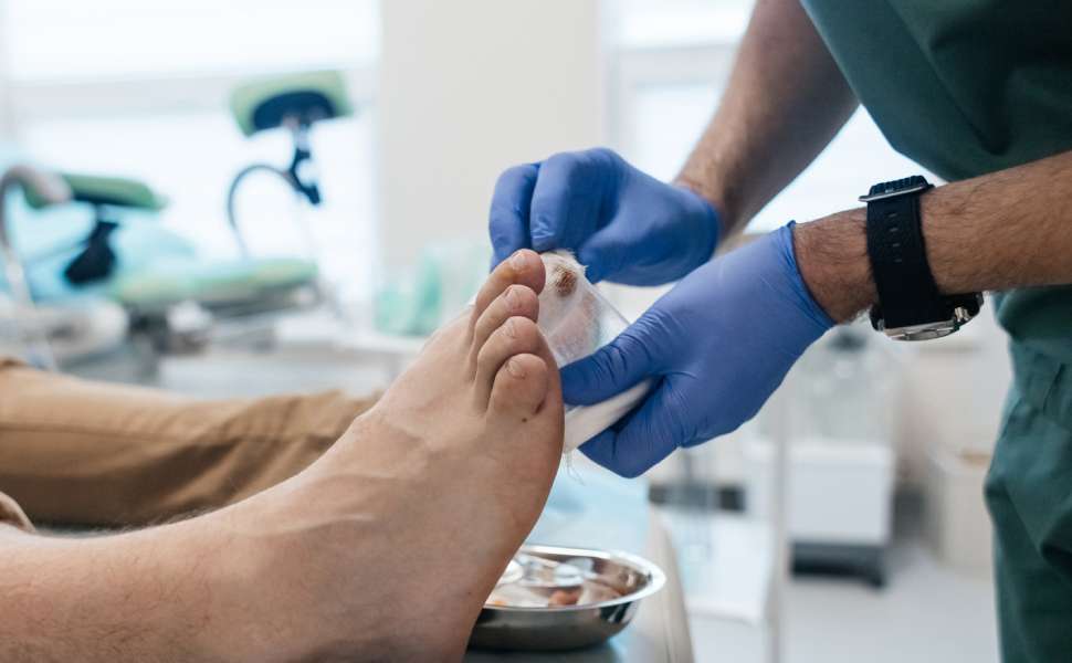Stop amputazioni: azioni concrete sul paziente diabetico in Calabria, congresso internazionale 52 piede diabetico