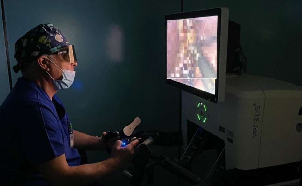 Chirurgia robotica oncologica: a Lamezia eseguito il primo intervento sul colon con sistema Versius 53 Lamezia - Chirurgia -Manfredo Tedesco bracci robotici
