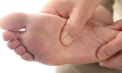 piede-diabetico pazienti
