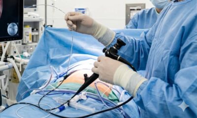 stent ureterale