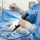 stent ureterale