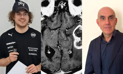 unical-glioblastoma-IA-studio