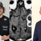unical-glioblastoma-IA-studio