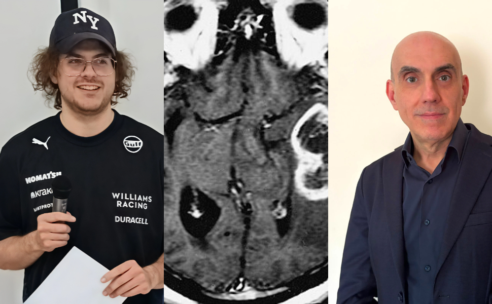 unical-glioblastoma-IA-studio