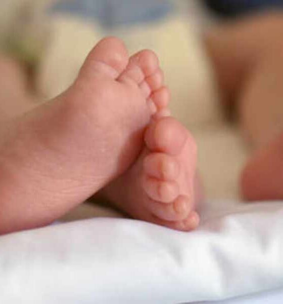 All'Annunziata il doppio "miracolo della vita": salvati 2 gemelli con una rara patologia 56 gemelli_Annunziata