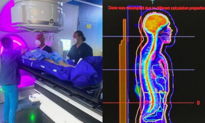 radioterapia-VMAT-gom-ospedale