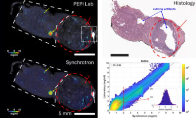 Vedere lo iodio dentro la tiroide in 3D: la nuova tecnica che arriva dall'Unical 58 tiroide-unical-ricerca-studio-1.