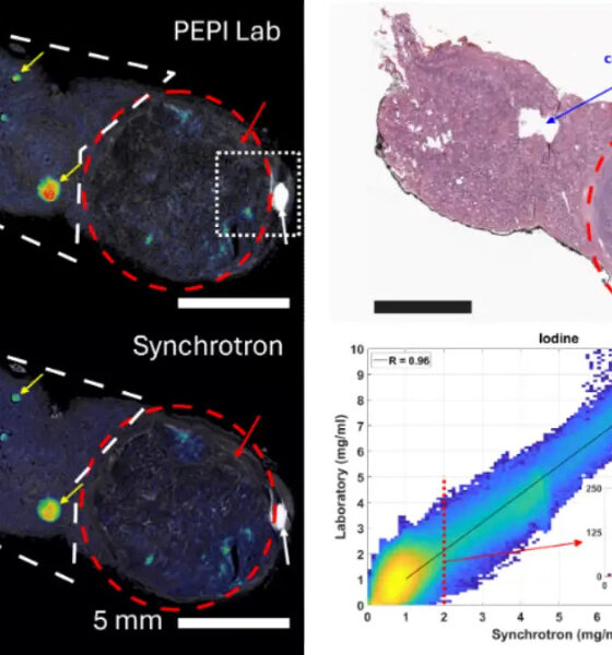 Vedere lo iodio dentro la tiroide in 3D: la nuova tecnica che arriva dall'Unical 56 tiroide-unical-ricerca-studio-1.