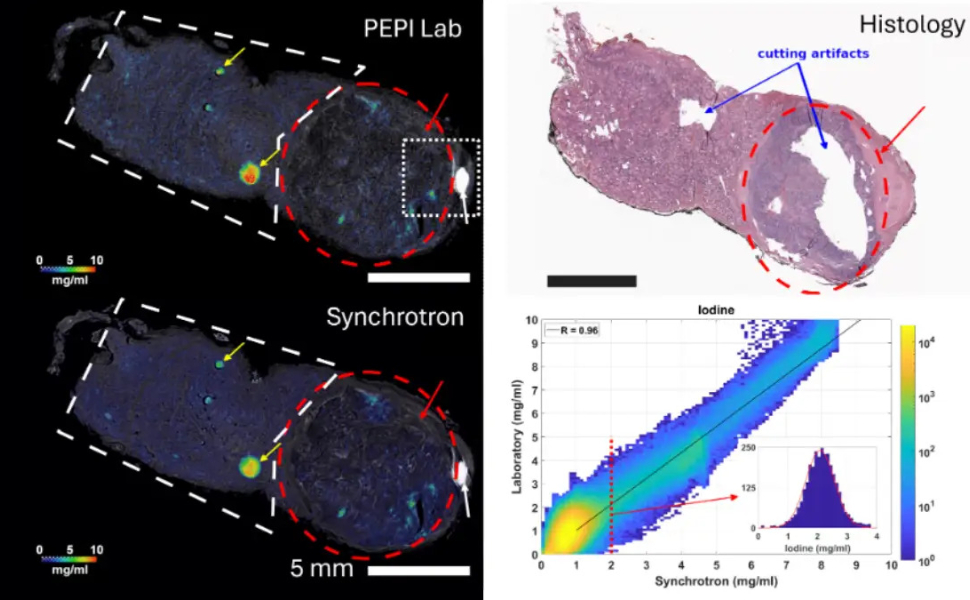Vedere lo iodio dentro la tiroide in 3D: la nuova tecnica che arriva dall'Unical 51 tiroide-unical-ricerca-studio-1.