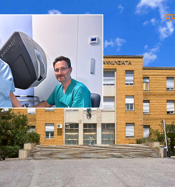 Chirurgia robotica annunziata di Cosenza