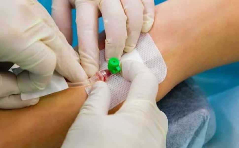 Accesso venoso nei pazienti oncologici, a Paola il congresso nazionale su tecniche e innovazione 53 accesso venoso 02
