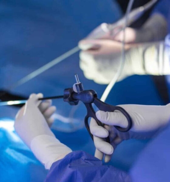 fibromi uterini-annunziata-cosenza-tecnica-mini-invasiva