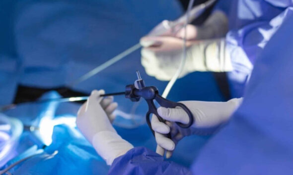 fibromi uterini-annunziata-cosenza-tecnica-mini-invasiva