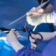 fibromi uterini-annunziata-cosenza-tecnica-mini-invasiva