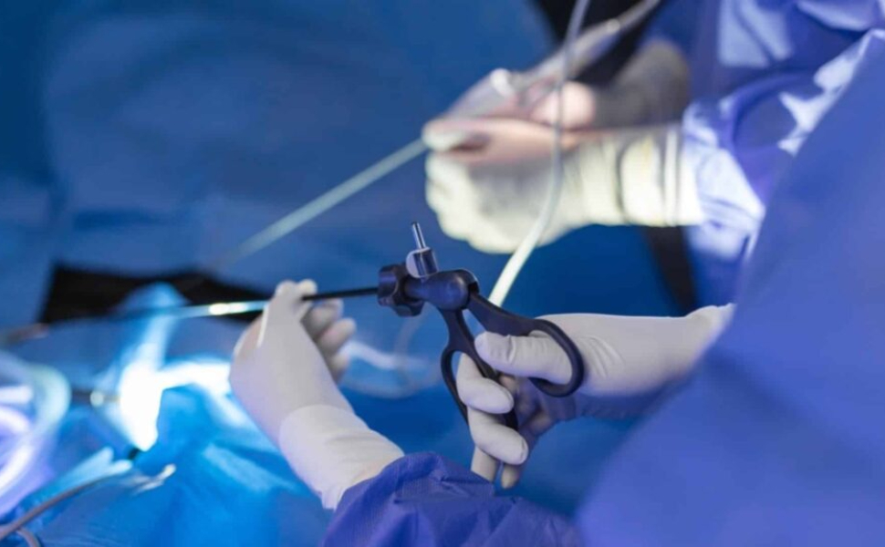 Fibromi uterini, svolta all’Annunziata di Cosenza: primo intervento con tecnica mini-invasiva 51 fibromi uterini-annunziata-cosenza-tecnica-mini-invasiva