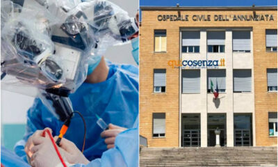 milza-asporta-annunziata-cosenza-ospedale